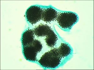 Photo de Microcystis, cyanobactérie toxique