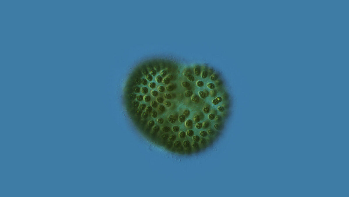 Microcystis, un genre de cyanobactérie d'eau douce capable de produire des toxines ©Proyecto agua Flickr