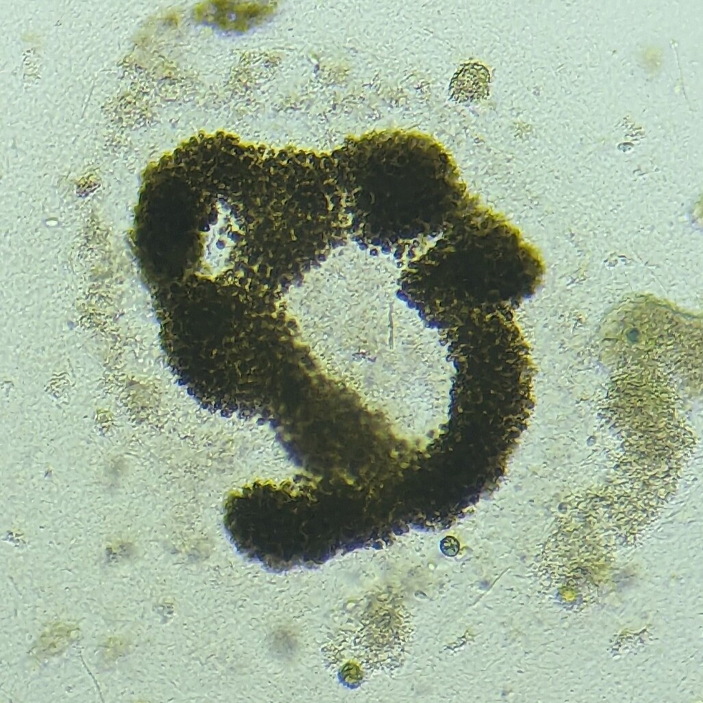 Microcystis aeruginosa, une cyanobactérie d'eau douce ©wikicommons